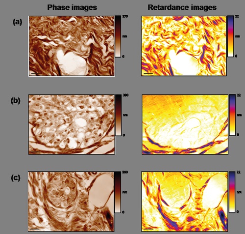 Birefringence imaging