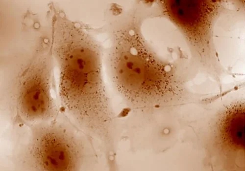 Cytology: single-cell characterization