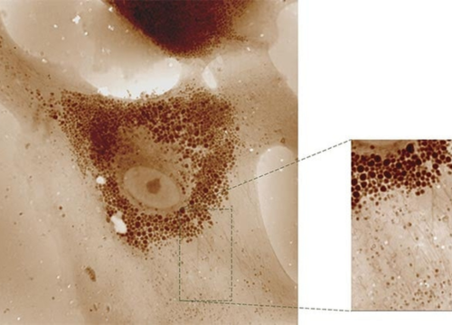 Seeing the Invisible: How QPI Reshapes Early Drug Response Assessment