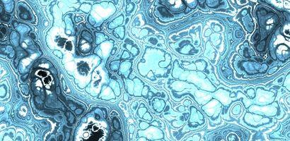 Quantitative Phase Imaging cameras